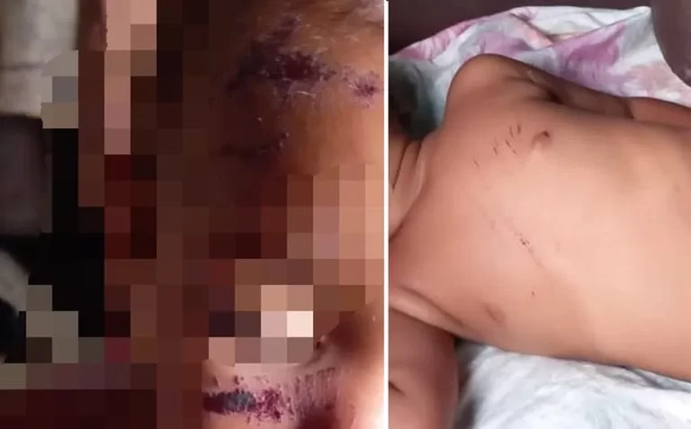 Menino de 1ano é jogado de barreira pelo próprio pai e tem ferimentos na cabeça e no corpo￼